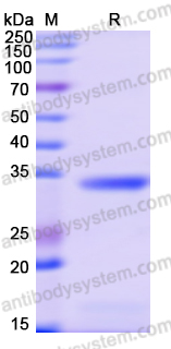 Recombinant Human RSAD2 Protein, N-His