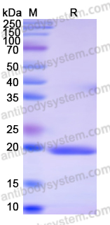 Recombinant Human UFD1 Protein, N-His