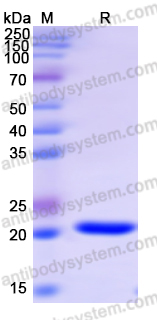 Recombinant Human ANKRD2 Protein, N-His