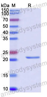 Recombinant Human CHMP2B Protein, N-His