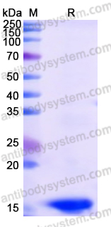 Recombinant Human DIO2 Protein, N-His