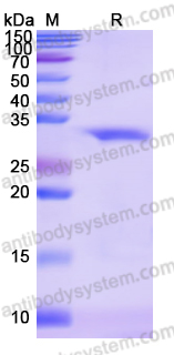 Recombinant Human TPK1 Protein, N-His