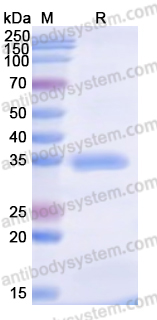 Recombinant Human METTL1 Protein, N-His