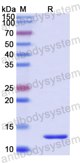 Recombinant Human NDUFB11 Protein, N-His