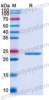 Recombinant Human QKI Protein, N-His
