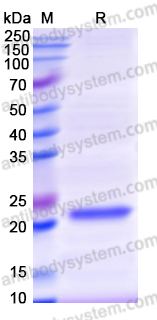 Recombinant Human RAB12 Protein, N-His