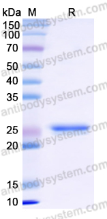Recombinant Human RAB39B Protein, N-His
