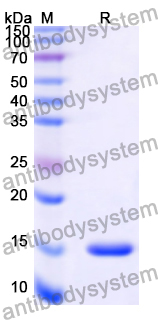 Recombinant Human RAB39B Protein, N-His