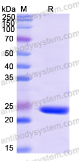 Recombinant Human RAB8B Protein, N-His