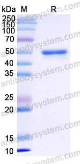 Recombinant Human SHOC2 Protein, N-His