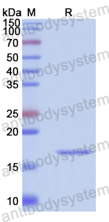 Recombinant Human TAX1BP1 Protein, N-His