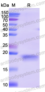 Recombinant Human NPRL2 Protein, N-His