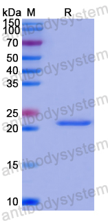 Recombinant Human YTHDC2 Protein, N-His