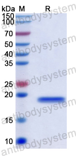 Recombinant Human CGGBP1 Protein, N-His
