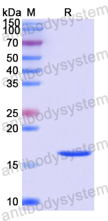 Recombinant Human CIAO2B Protein, N-His
