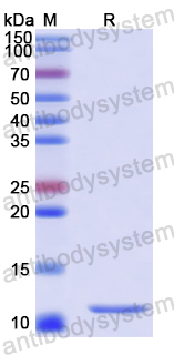 Recombinant Human MSI2 Protein, N-His