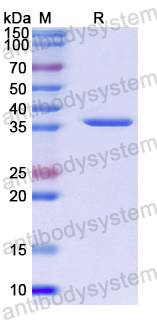 Recombinant Human PPAN Protein, N-His