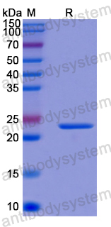 Recombinant Human RAB23 Protein, N-His