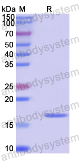 Recombinant Human WBP2NL Protein, N-His