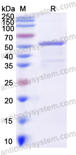 Recombinant Human CARM1 Protein, N-His