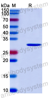 Recombinant Human DYNC2LI1 Protein, N-His