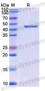 Recombinant Human EHD1 Protein, N-His