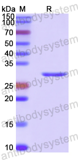Recombinant Human EXOC7 Protein, N-His
