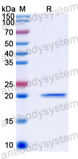 Recombinant Human FA2H Protein, N-His-SUMO
