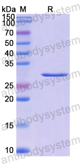 Recombinant Human MAPK8IP1 Protein, N-His