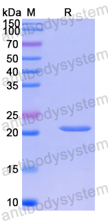 Recombinant Human SUGT1 Protein, N-His-SUMO