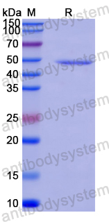 Recombinant Human UPF1 Protein, N-His