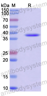 Recombinant Human ZC3H4 Protein, N-GST & C-His