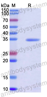 Recombinant Human SEPTIN8 Protein, N-His