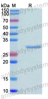 Recombinant Human TSGA10 Protein, N-His