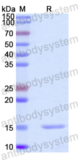 Recombinant Human CEP72 Protein, N-His