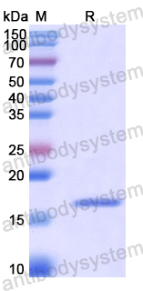 Recombinant Human KRT80 Protein, N-His