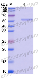Recombinant Human LGR6 Protein, N-His