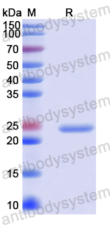 Recombinant Human NRDE2 Protein, N-His-SUMO
