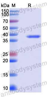Recombinant Human PTPN23 Protein, N-His