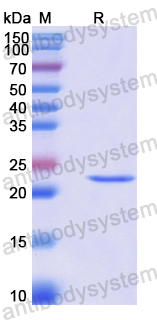 Recombinant Human OSCP1 Protein, N-His