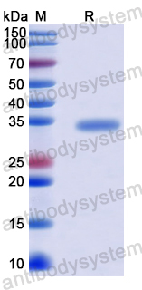 Recombinant Human ROGDI Protein, N-His