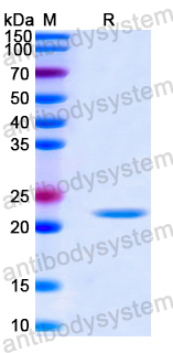 Recombinant Human SATB2 Protein, N-His