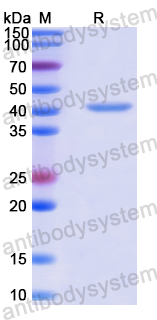 Recombinant Human GTPBP4 Protein, N-His