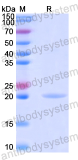 Recombinant Human WDR45 Protein, N-His
