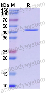 Recombinant Human ACTL7A Protein, N-His