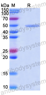 Recombinant Human INPP5D Protein, N-His