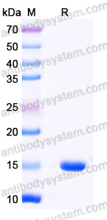 Recombinant Human WBP2 Protein, N-His