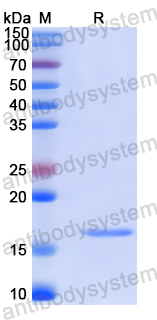 Recombinant Human NHEJ1 Protein, N-His