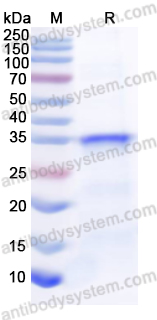 Recombinant Human KAT8 Protein, N-His