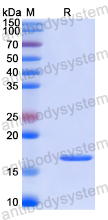 Recombinant Human HMG20A Protein, N-His